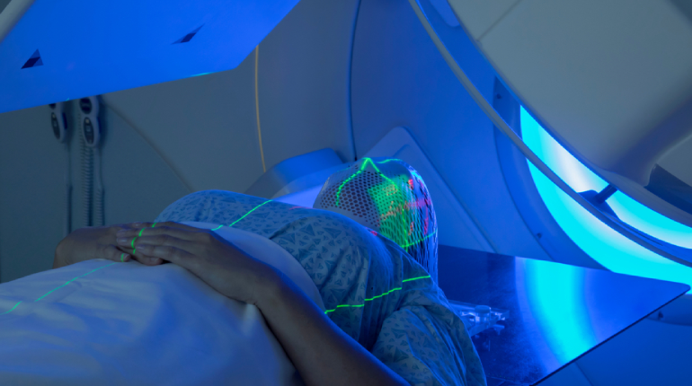 Neurosurgeon reviewing a brain scan to explain the early warning signs of a brain tumor you can watch for at home